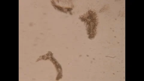 1960s Microscopic Close Up Of Cells Do Stock Video Pond5