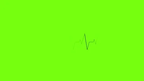 Heartbeat Line Animation Heart Rate He Stock Video Pond