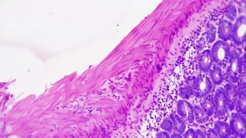 Small Human Intestine In Cross Section M Stock Video Pond5