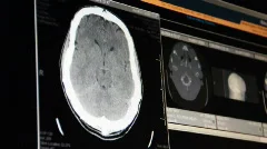 MRI Brain Scan Computer Screen Output