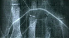 X-ray film background,Medical material.