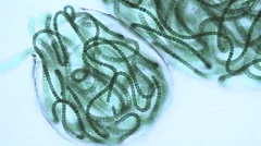 Microscopic view of sacks or bubbles containing chains of blue green algae