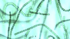 Microscopic view of chains of algae, these cyanobacteria, Microcystis sp.