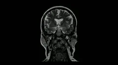 Computed tomography of the brain