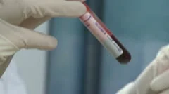 Corona Blood test for Covid-19 Virus carriers and infected patients recovery re-