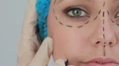 Video of woman with hair net and black dashes lines for a face lift