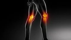 Knee joints walking man medical scan