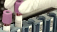 Scientist handling blood samples for testing