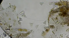vorticella and rotifers filtrating water under microscope 400x
