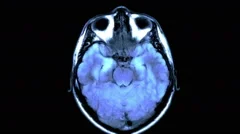 MRI Scan of the Brain - Top Down