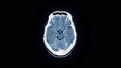 Human Brain MRI Scan
