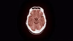 Human Brain MRI Scan