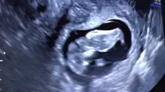 UltraSound of 11 week old Fetus