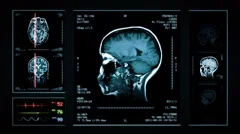 Brain, Knee, Neck MRI Scan. Blue. 3 in 1. Loopable. Magnetic Resonance Imaging.
