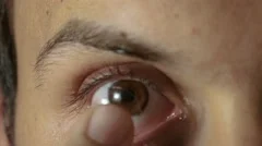 Young man put in contact lens