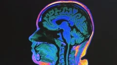 Human brain MRI scan