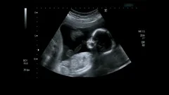Ultrasound of baby body in mother's womb