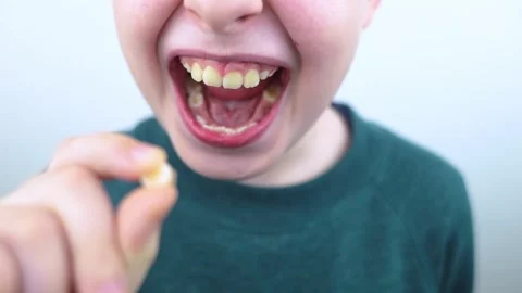 10 year old boy at pediatric dentist showing milk tooth extraction. Concept of c 스톡 동영상 335679736