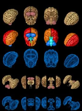 100 megapixels set - human brain with rontgen style image and colored zones Stock Illustration