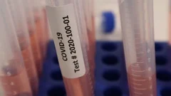 Coronavirus COVID-19 Rapid Test Pink Serum for Swab Nasopharyngeal Testing