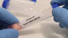 Coronavirus COVID-19 Nurse Testing Swab Results for Positive Negative Test