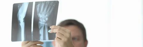 Close-up of female and male hands holding x-ray. Traumatologist and surgeon making diagnosis to patient. Practitioners discussing trauma. Traumatology and healthcare concept xkwx closeup, hand, holding, x-ray, skiagram, traumatologist, surgeon, diagnosis, patient, practitioner, discuss, trauma, traumatology, healthcare, concept, advice, colleague, work, hospital, look, xray, doctor, physician, examining, shadowgraph, therapist, medicine, disease, clinical, unhealthy, recovery, expert, clinic, specialist, healing, sick, illness, intern, practice, treatment, medic, medicines, professional, injury, diagnostic, cabinet, health, healthy