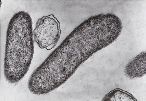 Scanning electron microscope photo - vibrio bacteria x76000 xkwx small, nano, tiny, microscope, micro, electron, science, research, scan, structure, study, surface, technology, treatment, zoom, view, physics, education, laboratory, magnification, metal, diseases, epidemic, experiment, ill, illness, microbiology, microbes, bacteria, medicine, cells, health, transmission, sickness, vibrio, virulent, gram negative, rods