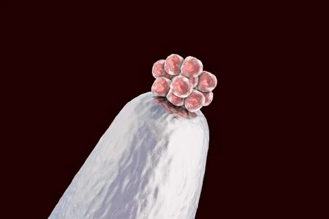 16-cell human embryo on a needle tip Stock Illustration