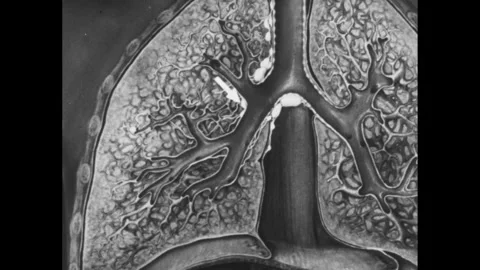 1940s: Diagram of a lung. Arrow points to swollen lymph nodes around the Stock Footage 254264139