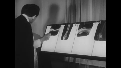 1940s: Doctors examine x-rays of broken arm on light box. Hand uses pen to point Stock Footage 116052776