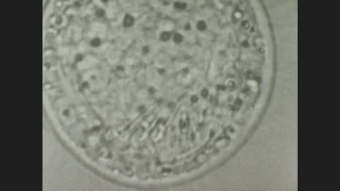 1940s: Hatched tapeworm embryo under microscope, movement of hooks is visible. Stock Footage 86227686