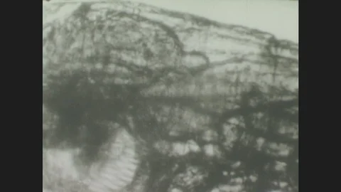 1940s: Under microscope, copepod body with tapeworm larva. Tapeworm larva in Stock Footage 86228567