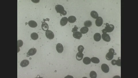1940s: Under microscope, hatched tapeworm embryos (coracidia) swim amongst Stock Footage 86227657