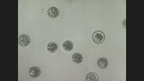 1940s: Under microscope, hatched tapeworm embryos (coracidia) begin to swim more Stock Footage 86227716