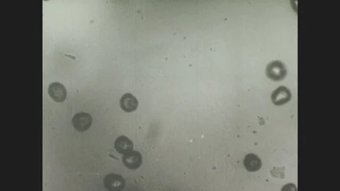 1940s: Under microscope, newly hatched tapeworm embryos (coracidia) have Stock Footage 86227690