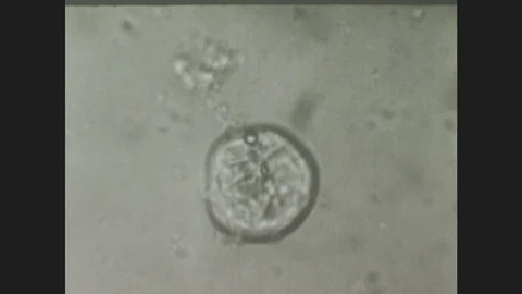 1940s: Under microscope, tapeworm oncosphere becomes active inside copepod Stock Footage 86228169