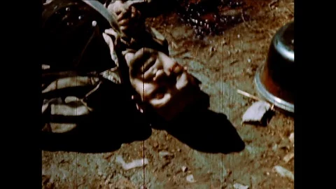 1945-Concentration Camp Prisoner / End of War / Germany / Mar 30, 1945 Stock Footage 77825805