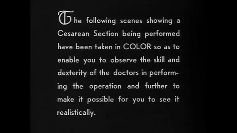1949 - Doctors begin a c-section on a woman and remove the infant. Stock Footage 143710539