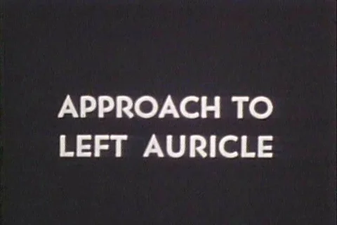 1950 - Drawings are used to render an anterior intercostal approach to left Stock Footage 99793330