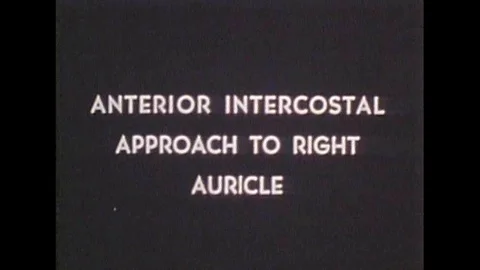 1950 - Drawings are used to render an anterior intercostal approach to right Stock Footage 115360681