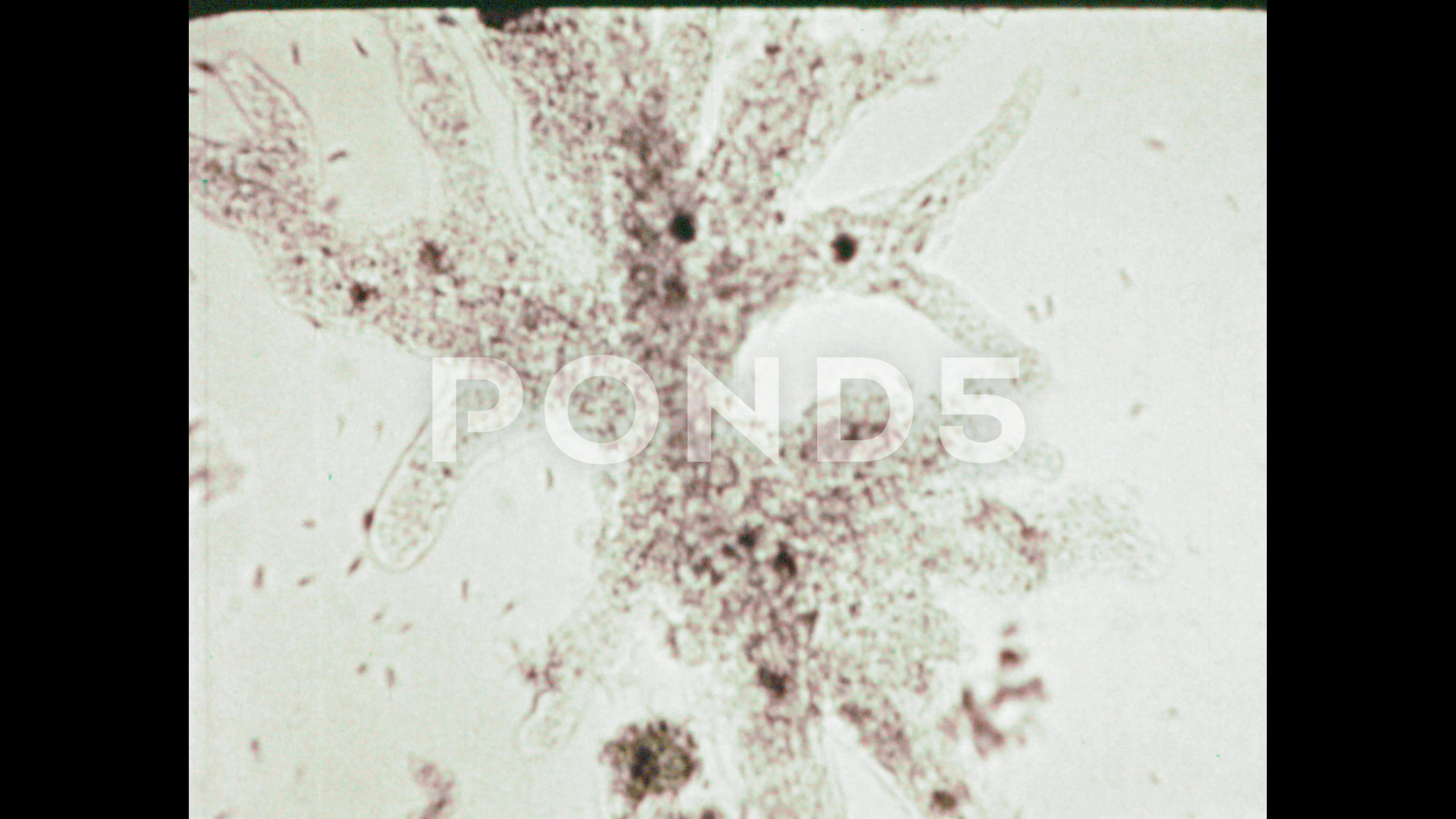 amoeba proteus 400x