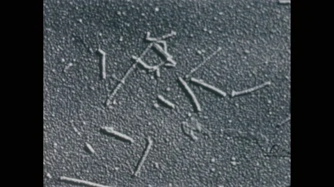 1950s: Cells viewed through an electron microscope. Unhealthy pink flower Stock Footage 221102869