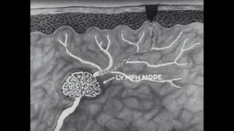 1950s: lymph fluid animation. Lymph fluid travels to lymph nodes. White blood Видео 312564802