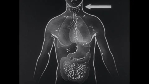1950s: map of lymph nodes and passages in the human body. Lymph nodes in the Stock Footage 312564870