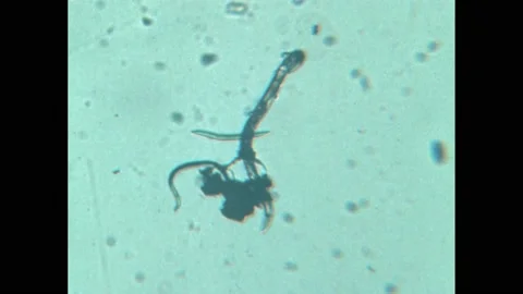1950s: Microscopic view of worm parasite. Planarian worm on glass. Stock Footage 194466403