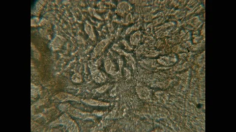 1950s: Microscopic view of wriggling bugs. Close-up of insect leg. Stock Footage 219818707