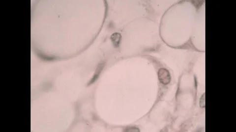 1950s: Red blood cells with some nucleated cells attached to them. Stock Footage 247451399