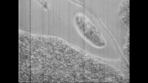 1950s: UNITED STATES: amoeba eats food. Amoeba engulfs food. Water sample under Stock Footage 83130050