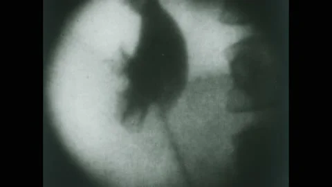 1950s: X-ray view of organs functioning. Kids play table tennis. 動画素材 224169093