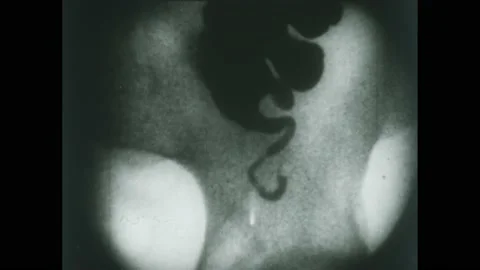 1950s: X-ray view of organs functioning. 動画素材 224169098